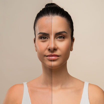Masajeador Facial Eléctrico